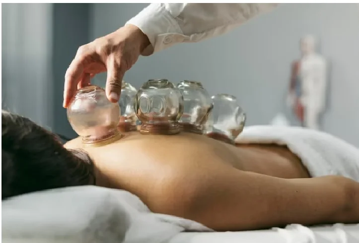 Cupping for Muscle Pain Relief